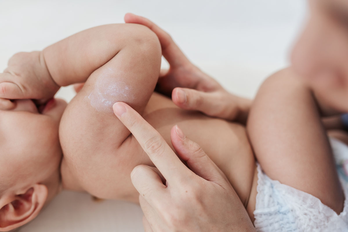 Baby liegt entspannt auf der Seite und lutscht am Daumen, während die Mutter eine trockene Hautstelle am Oberarm ihres Kindes eincremt als Sinnbild für die richtige Hautpflege für trockene Haut bei Babys