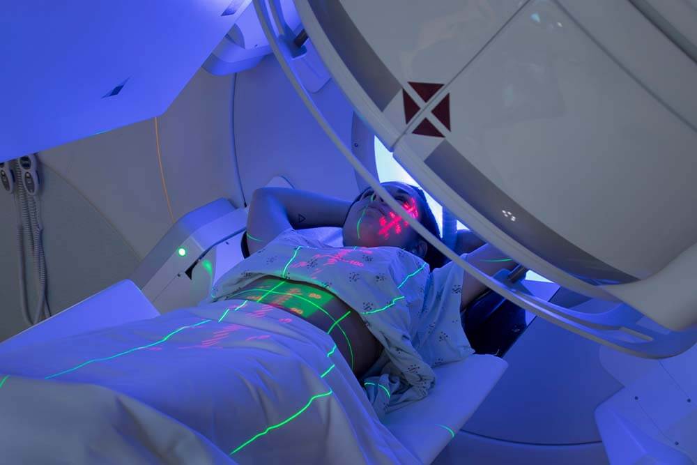 Strahlentherapie und Radiodermatitis